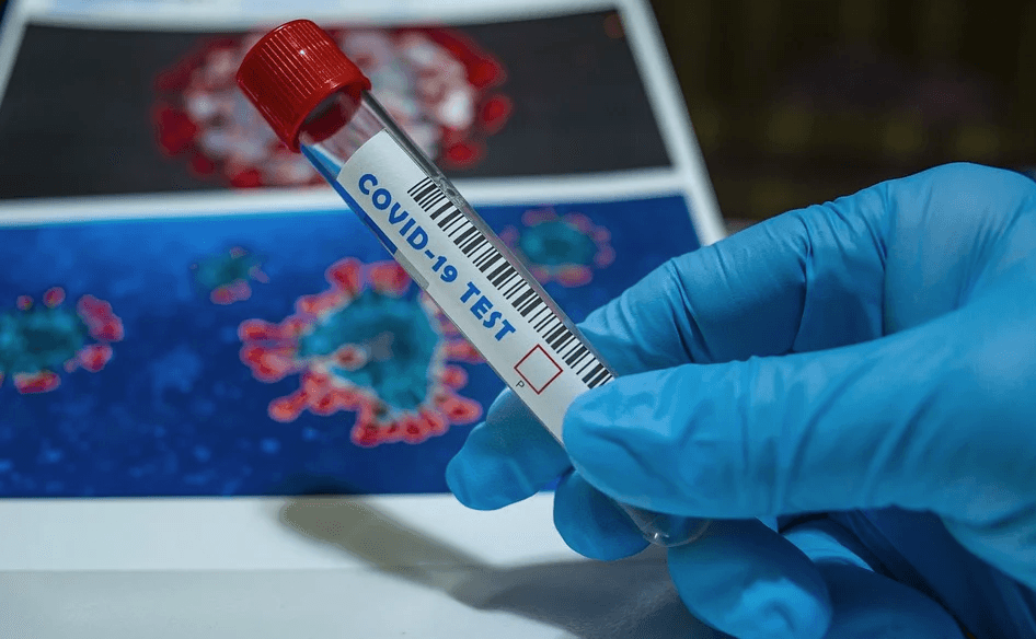 Empresas tendrán que pagar por pruebas rápidas para coronavirus, señala Canacintra